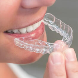 Aligners